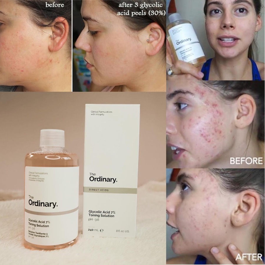 The Ordinary Direct Acids Glycolic Acid 7% Toning Solution 240ml.