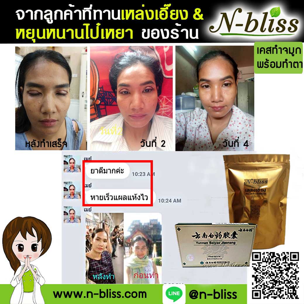 ชุดเตรียมพร้อมศัลยกรรมผ่าตัดเล็ก (หยุนหนานฯ กล่องครีมเขียว) ของแท้ 100% ร้านนี้มีเภสัชกรแผนไทยให้คำปรึกษา และได้รับทะเบียนการค้าพาณิชย์อิเล็กทรอนิกส์