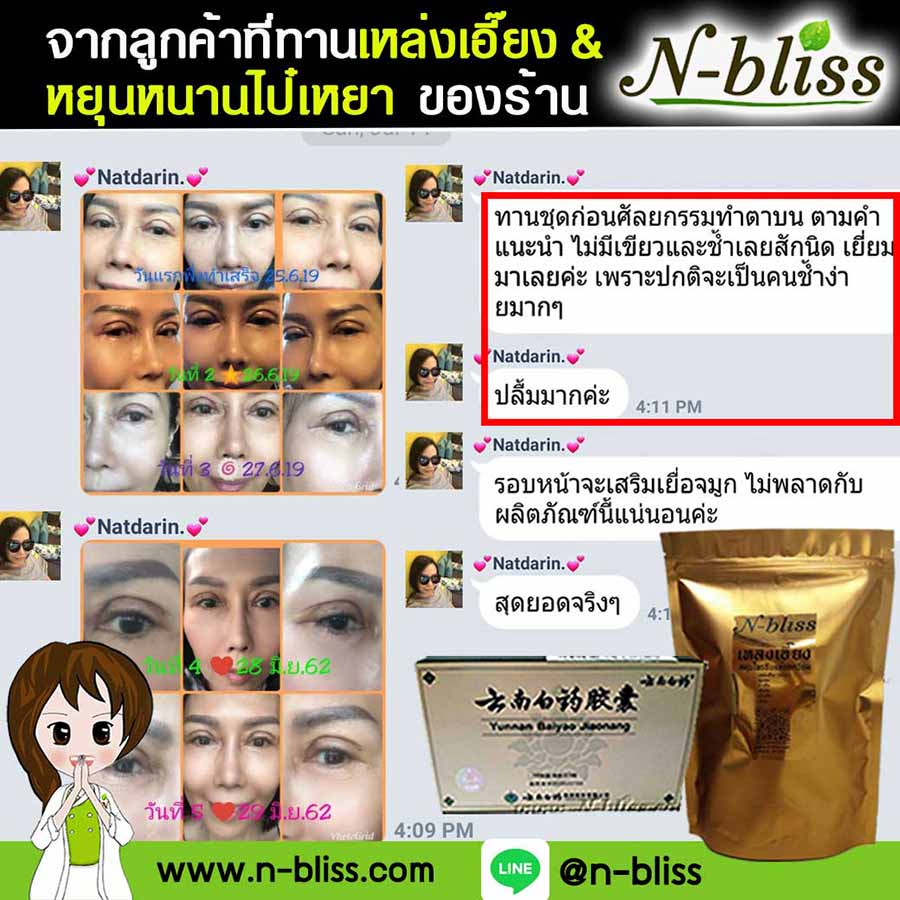 ชุดเตรียมพร้อมศัลยกรรมผ่าตัดเล็ก (หยุนหนานฯ กล่องครีมเขียว) ของแท้ 100% ร้านนี้มีเภสัชกรแผนไทยให้คำปรึกษา และได้รับทะเบียนการค้าพาณิชย์อิเล็กทรอนิกส์