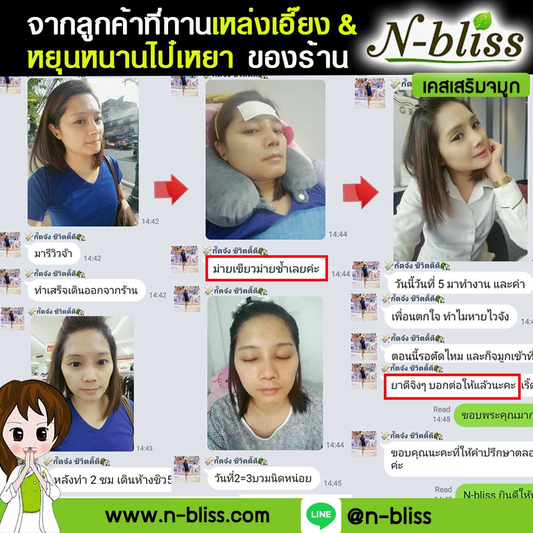 ชุดเตรียมพร้อมศัลยกรรมผ่าตัดเล็ก (หยุนหนานฯ กล่องครีมเขียว) ของแท้ 100% ร้านนี้มีเภสัชกรแผนไทยให้คำปรึกษา และได้รับทะเบียนการค้าพาณิชย์อิเล็กทรอนิกส์