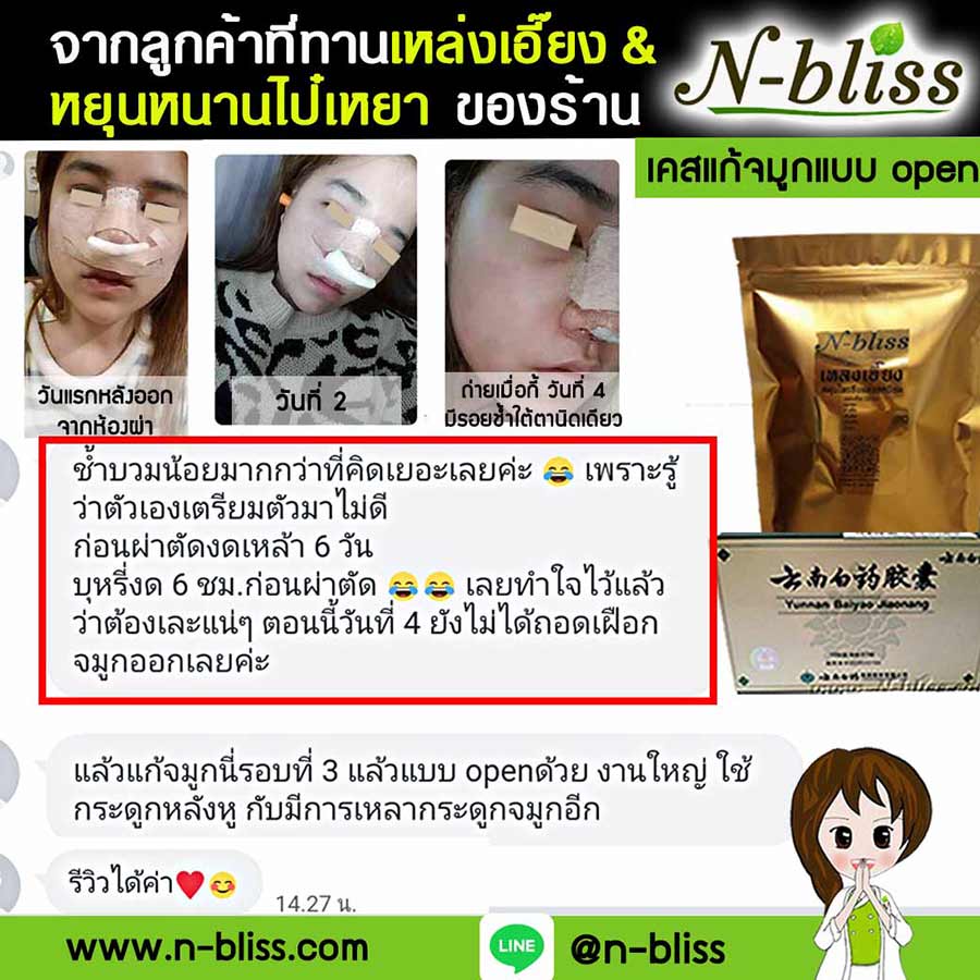 ชุดเตรียมพร้อมศัลยกรรมผ่าตัดเล็ก (หยุนหนานฯ กล่องครีมเขียว) ของแท้ 100% ร้านนี้มีเภสัชกรแผนไทยให้คำปรึกษา และได้รับทะเบียนการค้าพาณิชย์อิเล็กทรอนิกส์