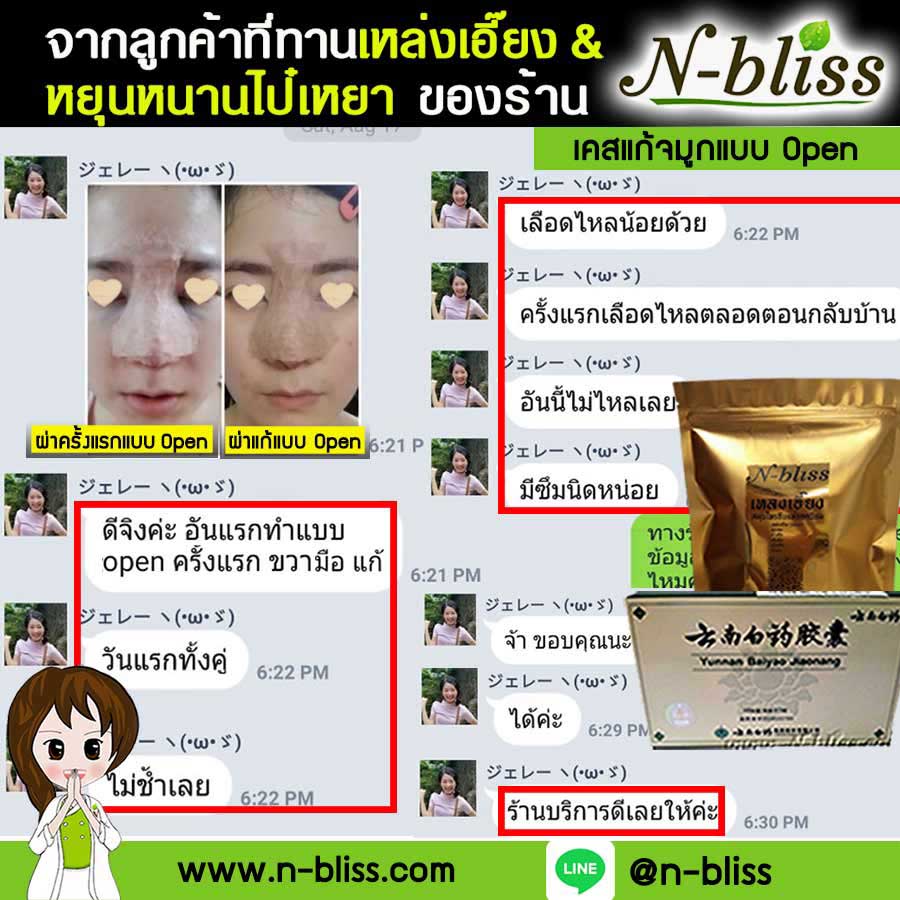 ชุดเตรียมพร้อมศัลยกรรมผ่าตัดเล็ก (หยุนหนานฯ กล่องครีมเขียว) ของแท้ 100% ร้านนี้มีเภสัชกรแผนไทยให้คำปรึกษา และได้รับทะเบียนการค้าพาณิชย์อิเล็กทรอนิกส์