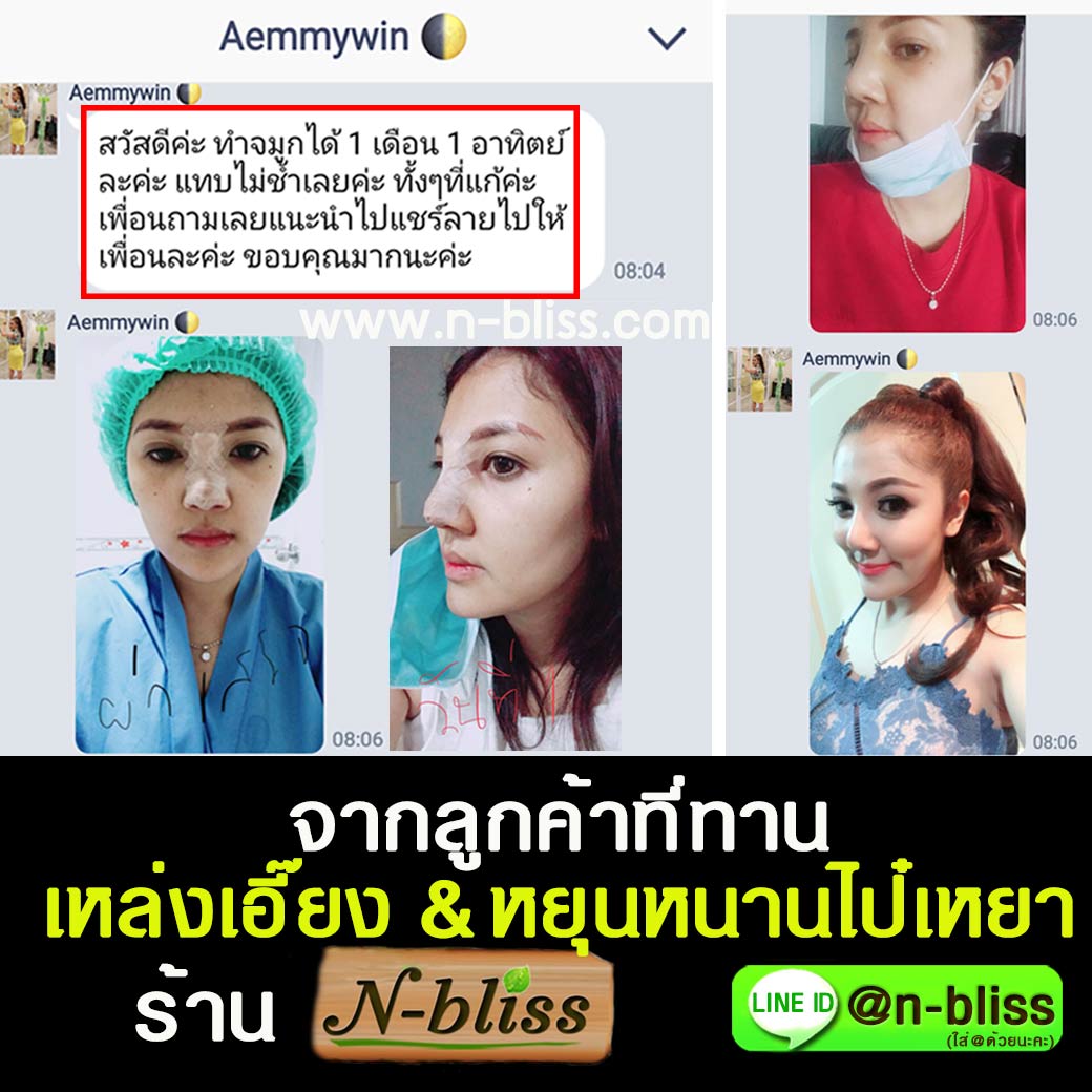 ชุดเตรียมพร้อมศัลยกรรมผ่าตัดเล็ก (หยุนหนานฯ กล่องครีมเขียว) ของแท้ 100% ร้านนี้มีเภสัชกรแผนไทยให้คำปรึกษา และได้รับทะเบียนการค้าพาณิชย์อิเล็กทรอนิกส์