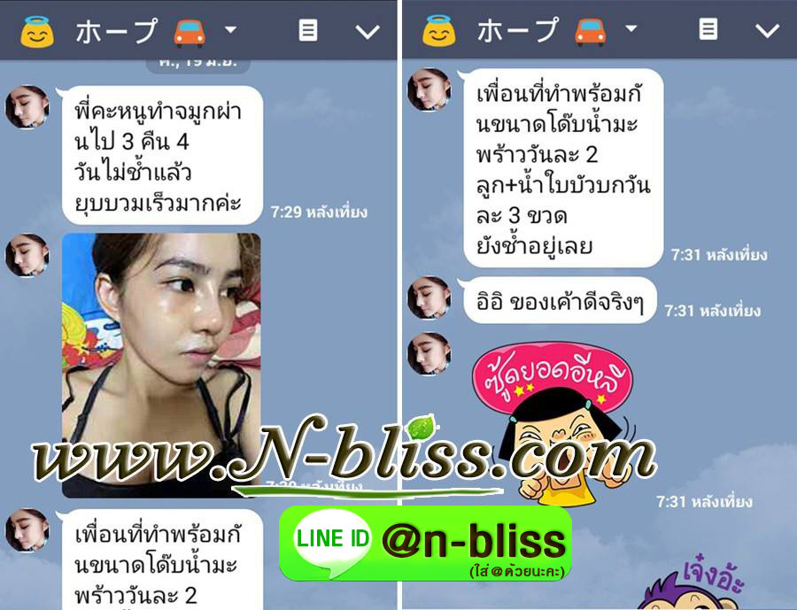 ชุดเตรียมพร้อมศัลยกรรมผ่าตัดเล็ก (หยุนหนานฯ กล่องครีมเขียว) ของแท้ 100% ร้านนี้มีเภสัชกรแผนไทยให้คำปรึกษา และได้รับทะเบียนการค้าพาณิชย์อิเล็กทรอนิกส์