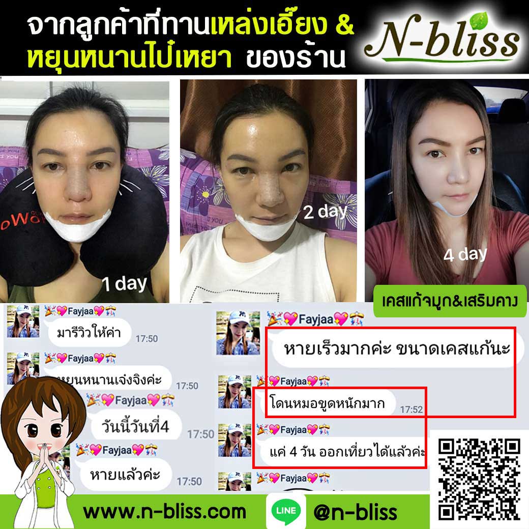 ชุดเตรียมพร้อมศัลยกรรมผ่าตัดเล็ก (หยุนหนานฯ กล่องครีมเขียว) ของแท้ 100% ร้านนี้มีเภสัชกรแผนไทยให้คำปรึกษา และได้รับทะเบียนการค้าพาณิชย์อิเล็กทรอนิกส์