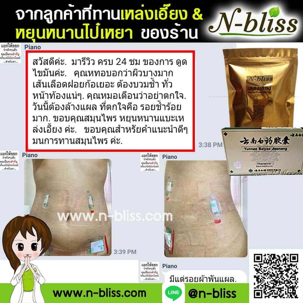 ชุดเตรียมพร้อมศัลยกรรมผ่าตัดเล็ก (หยุนหนานฯ กล่องครีมเขียว) ของแท้ 100% ร้านนี้มีเภสัชกรแผนไทยให้คำปรึกษา และได้รับทะเบียนการค้าพาณิชย์อิเล็กทรอนิกส์