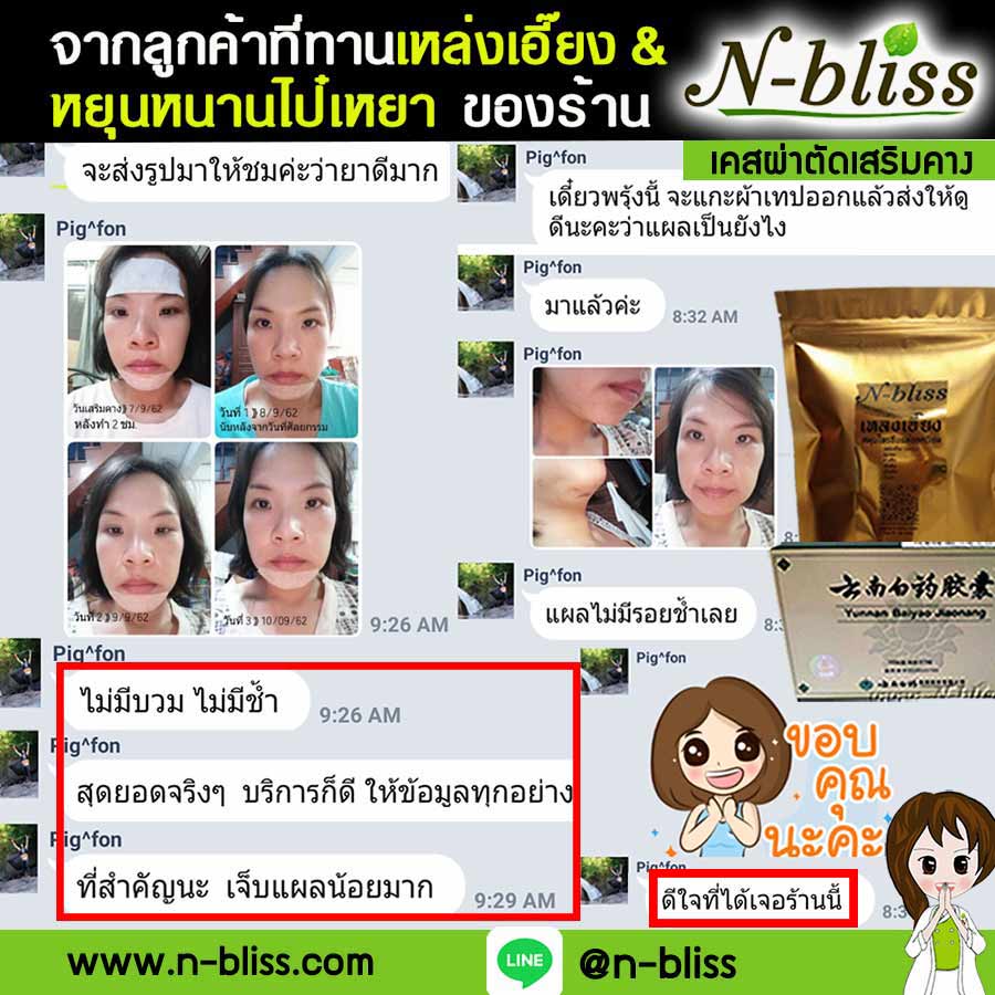 ชุดเตรียมพร้อมศัลยกรรมผ่าตัดเล็ก (หยุนหนานฯ กล่องครีมเขียว) ของแท้ 100% ร้านนี้มีเภสัชกรแผนไทยให้คำปรึกษา และได้รับทะเบียนการค้าพาณิชย์อิเล็กทรอนิกส์