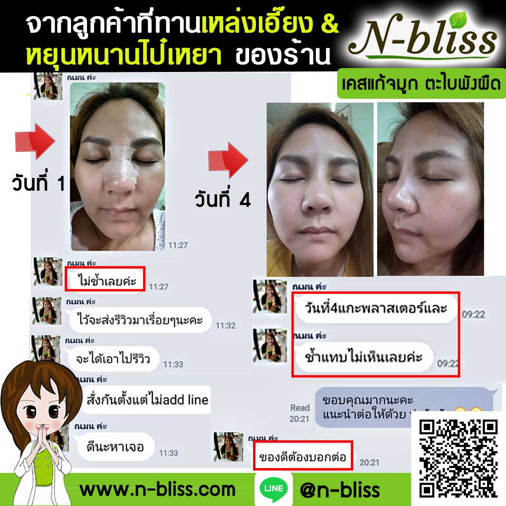 ชุดเตรียมพร้อมศัลยกรรมผ่าตัดเล็ก (หยุนหนานฯ กล่องครีมเขียว) ของแท้ 100% ร้านนี้มีเภสัชกรแผนไทยให้คำปรึกษา และได้รับทะเบียนการค้าพาณิชย์อิเล็กทรอนิกส์